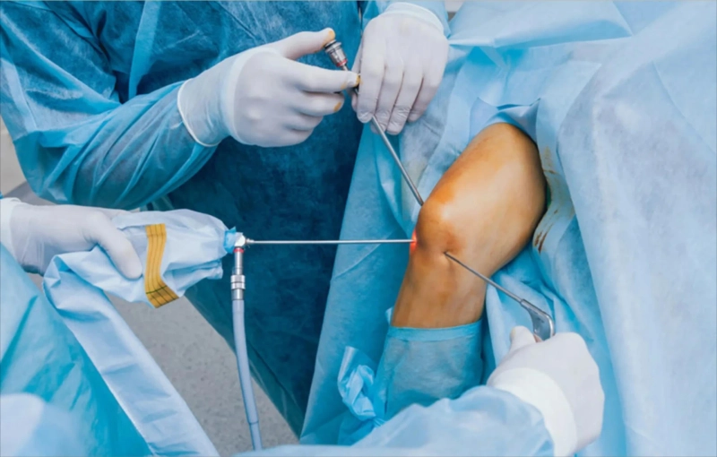 Arthroscopy Surgery Delhi : Diagnosis and Treatment in One Procedure