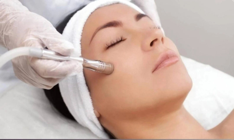 What to Expect from a Microdermabrasion Facial?
