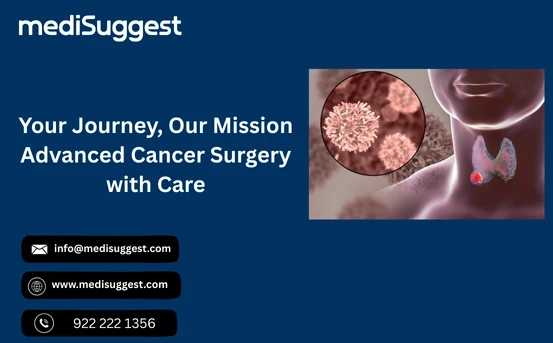 Head and Neck Cancer Treatments: Advanced Care for Better Recovery