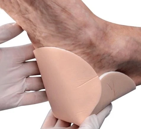 Demand for Foam Dressing Market to Witness Rapid Surge During the Period 2018–2026