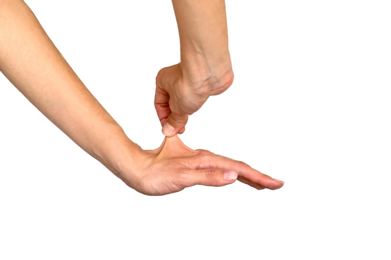 Size and Share of Ehlers-Danlos Syndrome Market by 2033