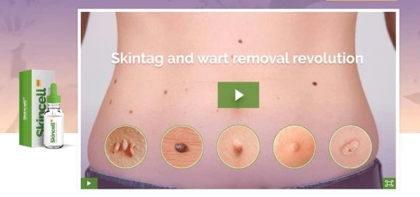 Planters Wart Removal - The Best Ways