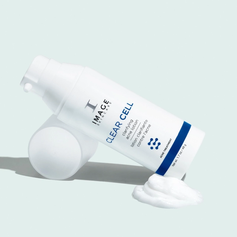 Surprising Reasons for Adult Acne and How to Care for It