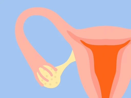 Poor Ovarian Reserve and Infertility - What Need to Know