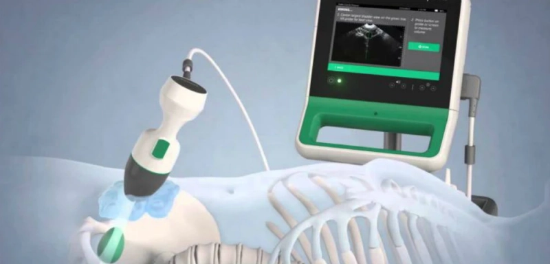 Bladder Scanner Market Analysis
