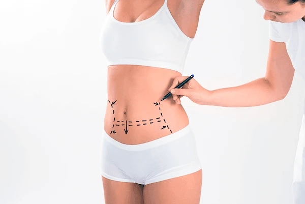 Where to Get Non-Surgical Treatment for Liposuction Fibrosis?