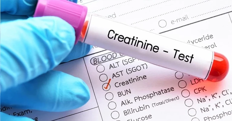 What happens when creatinine is high?