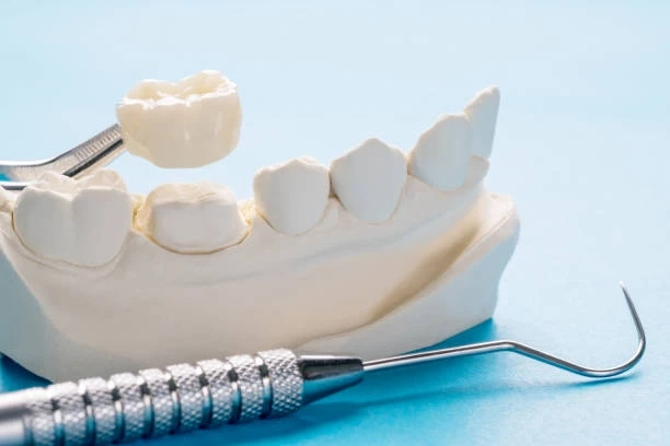 Benefits of Dental Crowns: Strength, Function, and Aesthetics