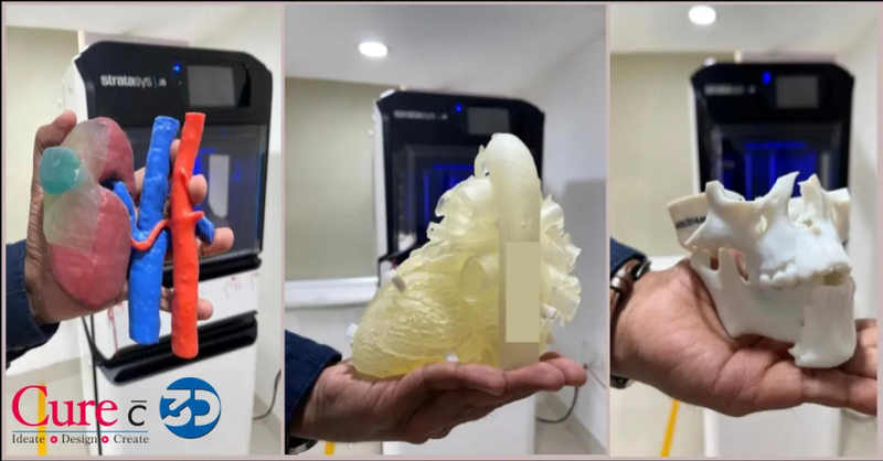 Why 3D-Printed Implants Are Changing the Future of Healing