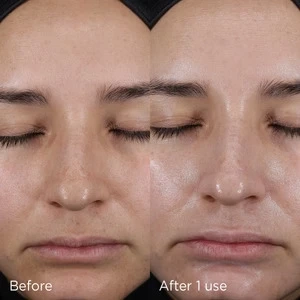 4 Ways to Prevent Environmental Damage to Your Skin