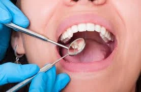 India Oral Hygiene Market Size to Grow at a CAGR of 5.3% in the Forecast Period of 2023-2028