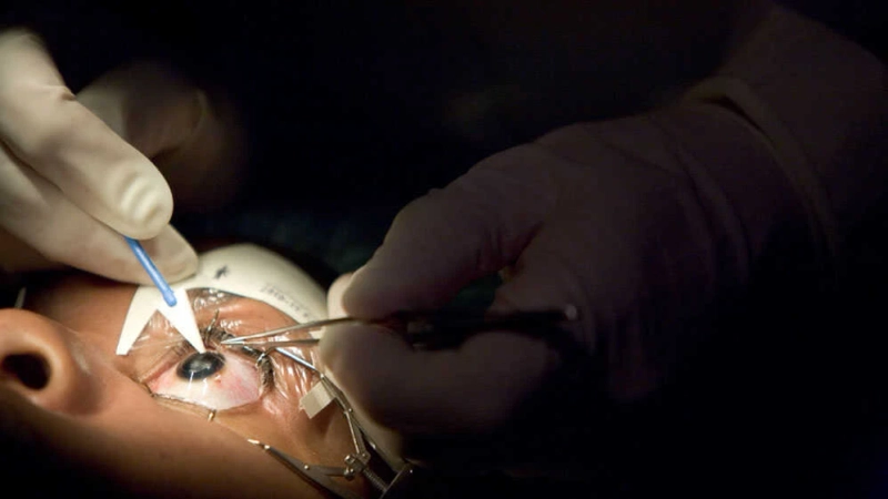 Is LASIK Painful: 5 Common Misconceptions About Laser Eye Surgery