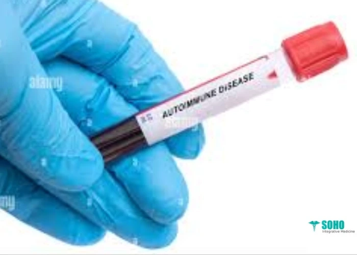 Why More Patients Are Turning to Integrative Autoimmune Specialists Instead of Conventional Care