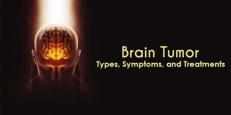 BRAIN TUMOR TYPES, SYMPTOMS, AND TREATMENTS