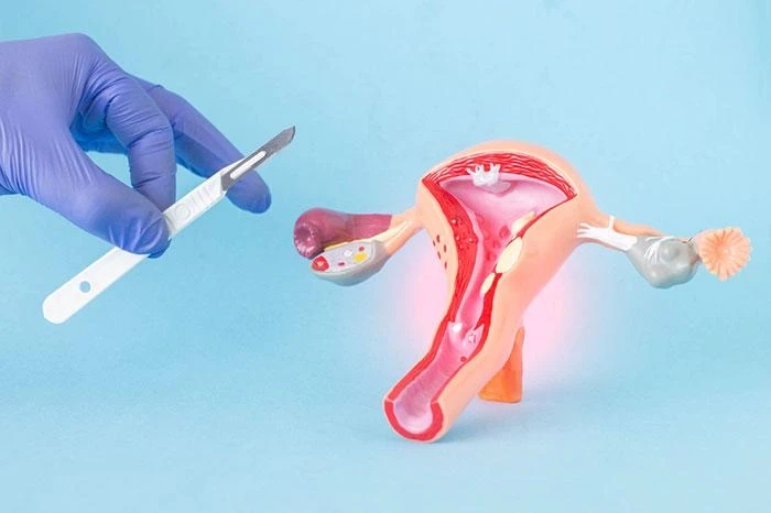 Thriving in Indore: Overcoming Uterine Fibroids and Restoring Fertility