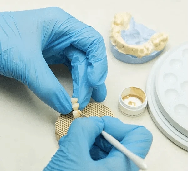 Services in Restorative Dentistry