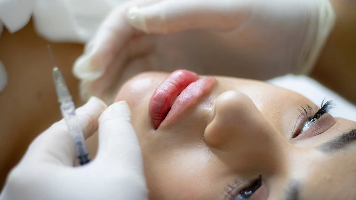 Avoiding Common Mistakes: What Not to Do After Getting Derma Fillers