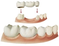 5 Reasons Why the Best Dental Clinic in South Delhi is Essential for Your Oral Health