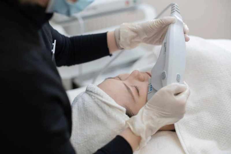 The Ultherapy Revolution