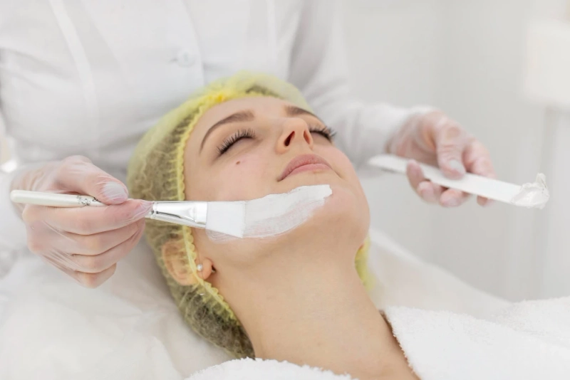 How Chemical Peels Improve Skin Texture and Tone