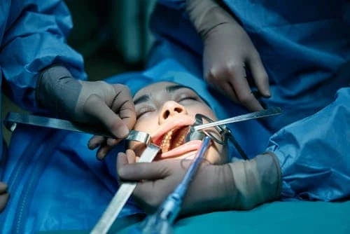 4 Effective ways to repair your broken or cracked tooth