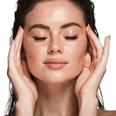 The ABCs of Melasma Treatment: A Holistic Approach