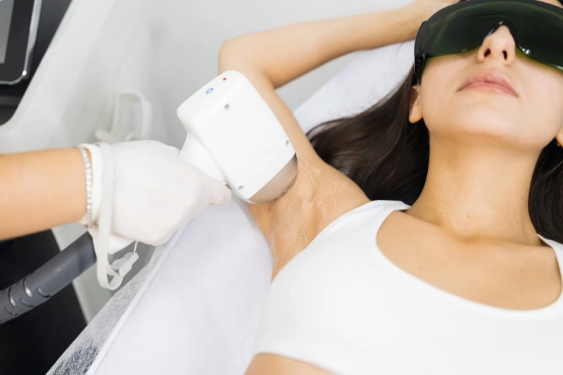 Laser Hair Removal Treatment- Everything You Need to Know