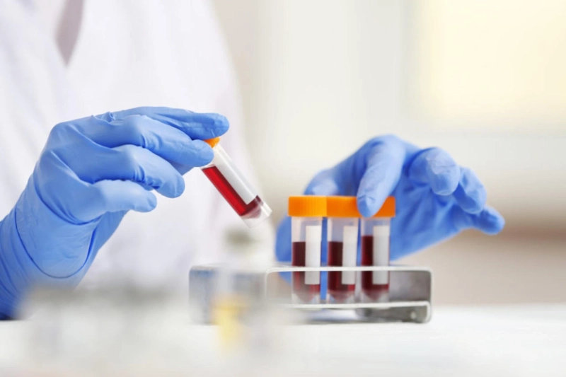 Blood draw at home services: Unlocking the Power of Personalized Healthcare