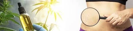 CBD Oil and its Benefits