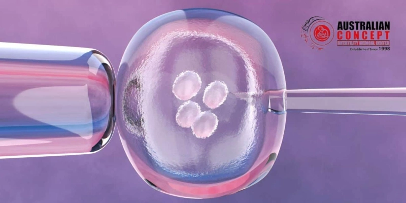 What Are the 5 Stages of IVF - Know The Process