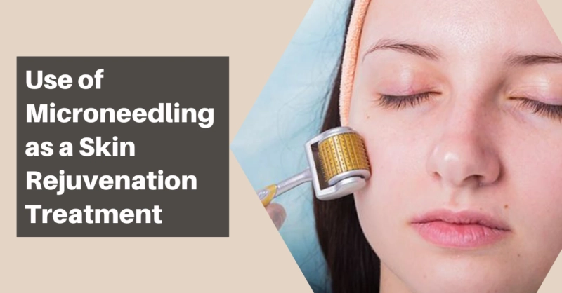 Use of Microneedling as a Skin Rejuvenation Treatment