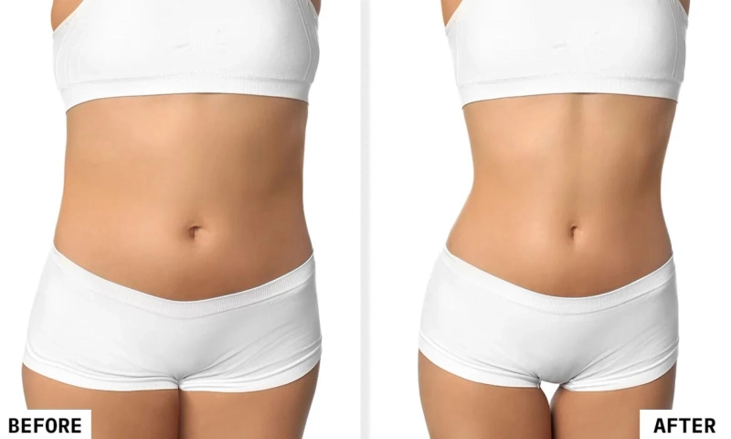 Popular Body Sculpting Techniques in Sugar Land Explained