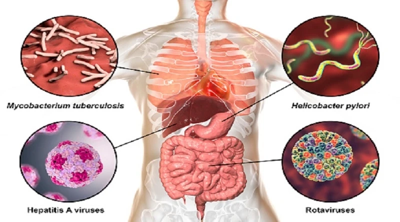 Tips to improve Gut Health