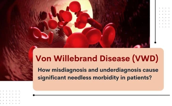 vWD: What is it? And What Do We Know About It?