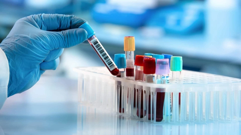 Autoimmune Disease Diagnosis Market Size, Share, Growth, Trends Report 2021-26