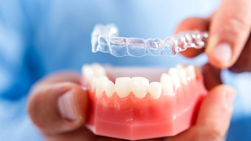 How Smile Makeover and Aligner Treatment Can Boost Confidence