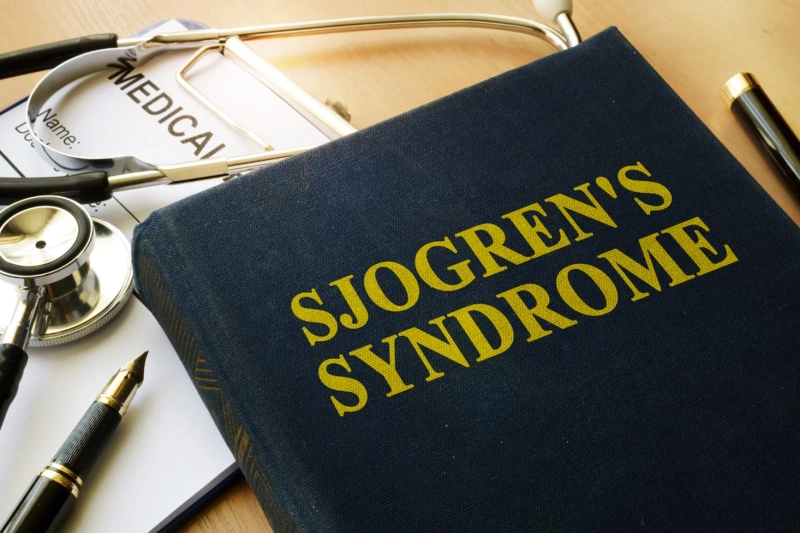 Find Out If You Qualify for Medical Studies on Sjögren's Syndrome in San Antonio