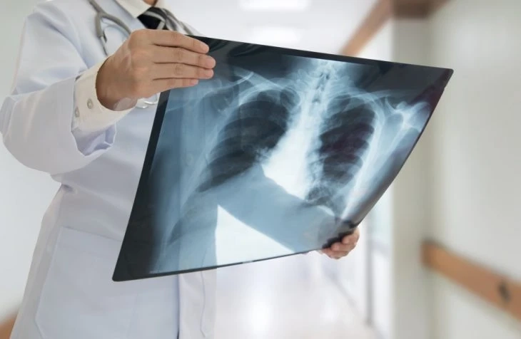 Development of Artificial Intelligence (AI) tool to detect COVID-19 condition from a chest X-ray ima