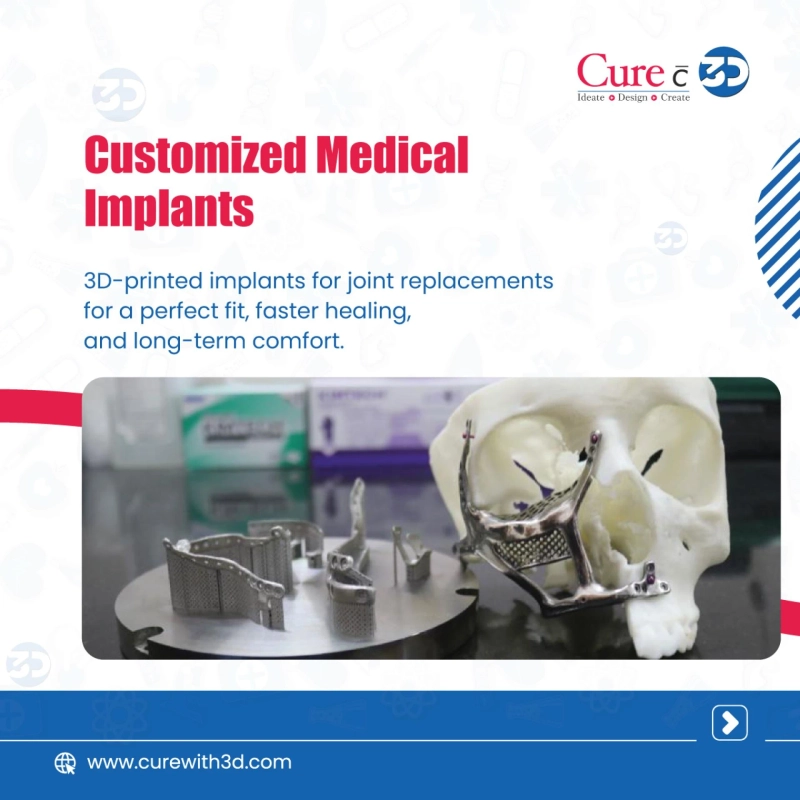 Why 3D Printed Implants Are the Future of Orthopedics and Dentistry?