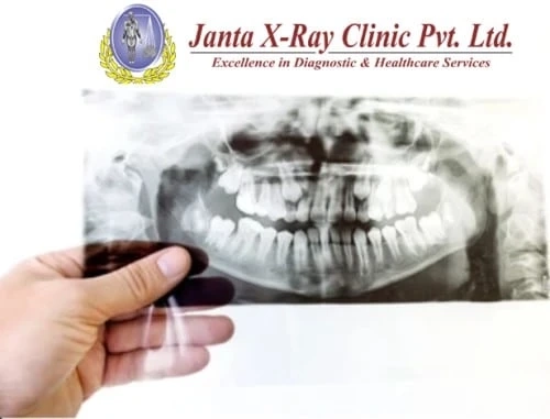 What Is OPG X-ray?