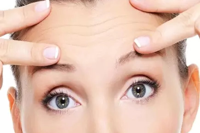 The Forehead Lift Revolution: Embracing Change