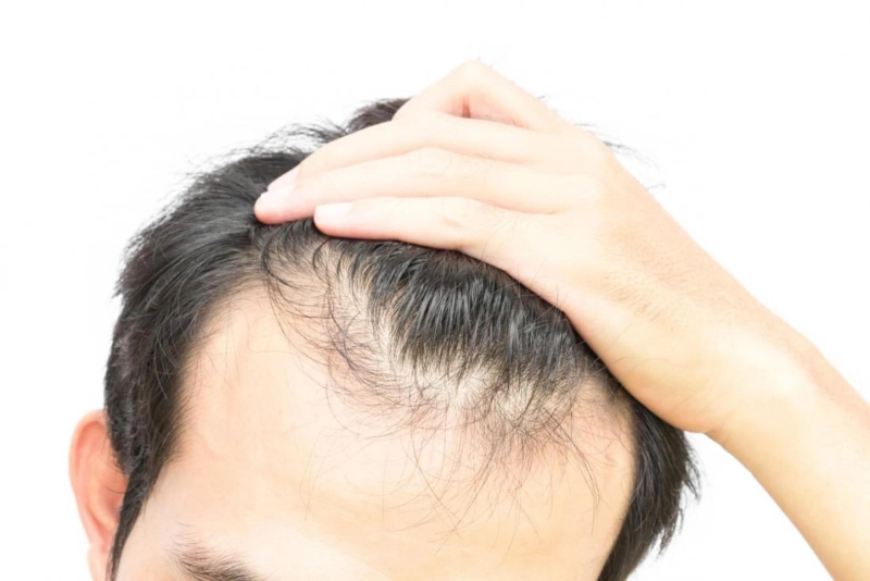 Does Onion Juice Really Help with Hair Regrowth?