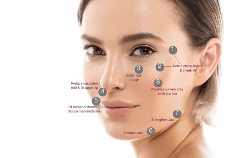 How Long Does an 8-Point Facelift Last?