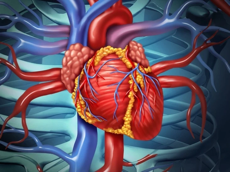 WHAT IS BEATING HEART BYPASS SURGERY?