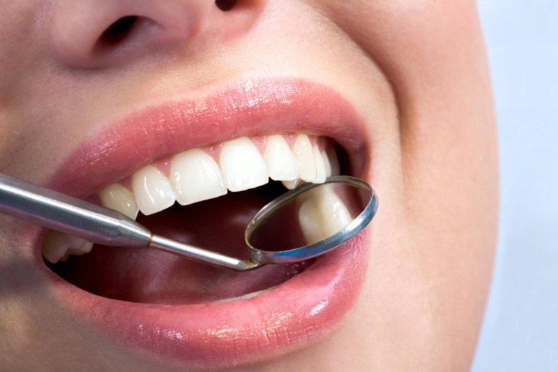 Practical Tips for Preventive Dental Care From Burke Dentists