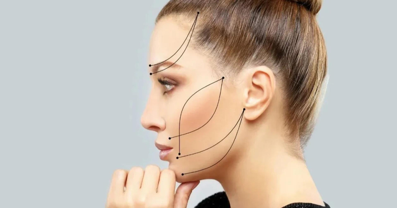 How Much Endolift Treatment Cost in Miami Clinics