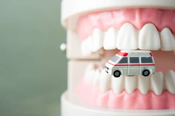 Why Quick Response Matters in Dental Emergencies