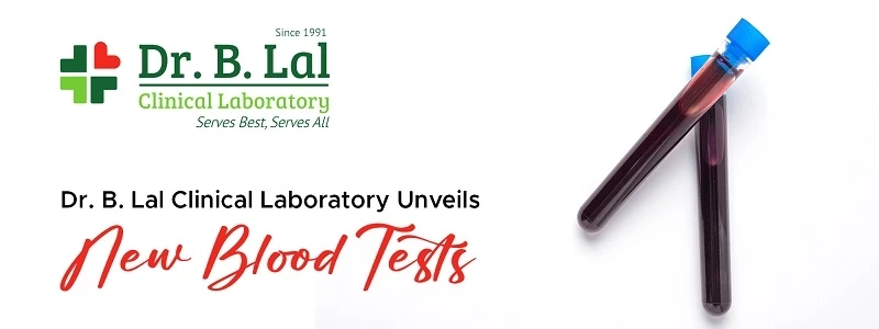 Complete Blood Count Test – An Understanding