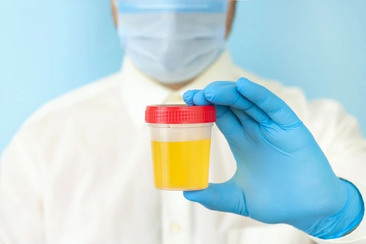 Urinalysis Market Set to Flourish with Increasing Demand and Advancements by 2031