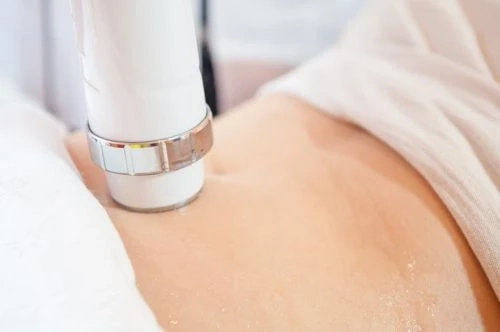 Laser Fat Reduction: Unveiling the Secrets of a Sculpted Figure